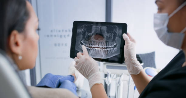 Licensed Tooth Extraction service in Lakeport, CA - Smile Center Dentistry